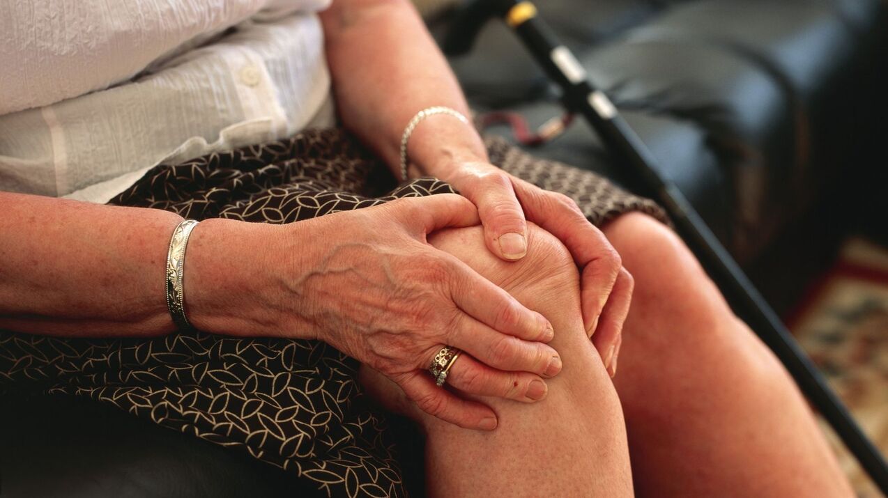 Osteoarthritis of the knee in an elderly woman