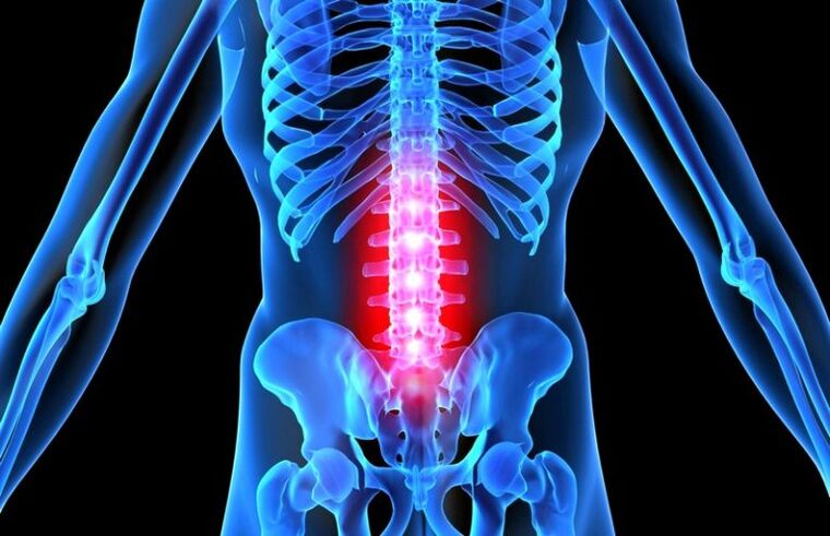 spinal injury with lumbar osteochondrosis