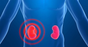 Signs of pain in the kidneys