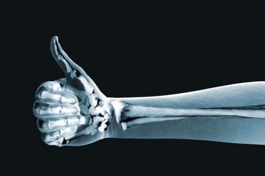 X-ray can help diagnose pain in finger joints
